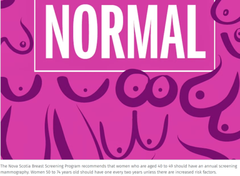 The Nova Scotia Breast Screening Program recommends that individuals who are aged 40 to 49 should have an annual screening mammogram. Individuals 50 to 74 years old should have one every two years unless there are increased risk factors. 